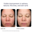 Triple Exfoliation Peel Pads
