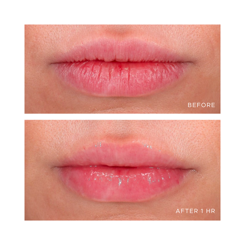 Anfisa ÂN-GLOSS